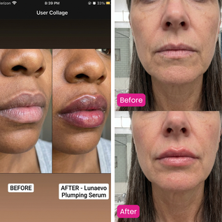 Lunaevo Plumpify™ Lip Plumping Serum