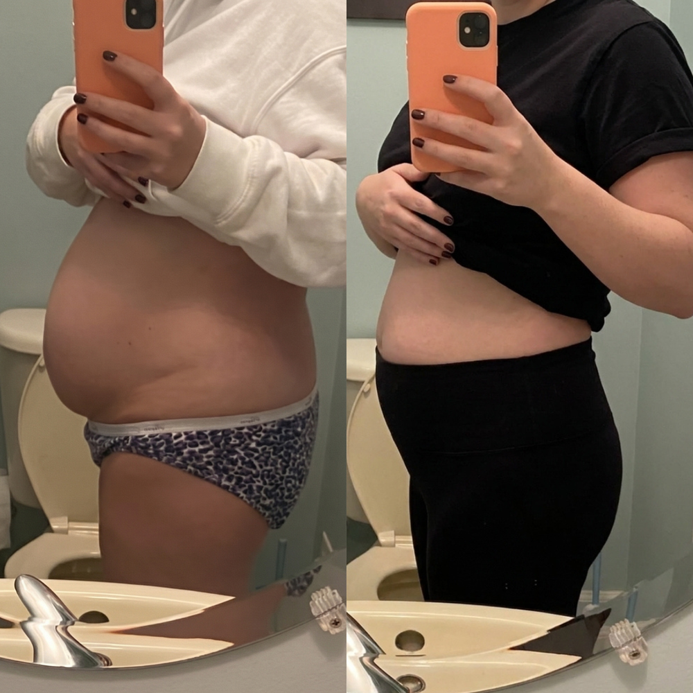 It's The Only Supplement Built Specifically For The Postpartum Lymphatic System